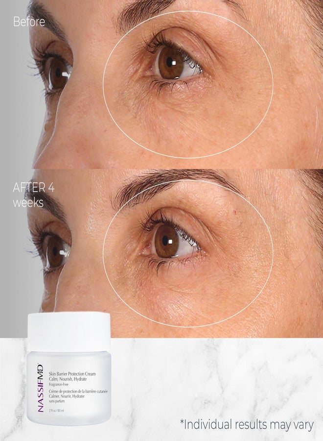 NassifMD Skin Barrier Protection Cream with Centella Asiatica - Healing Moisturizer for Sensitive & Post-Treatment Skin - Reduces Redness, Plumps Fine Lines - Image 2