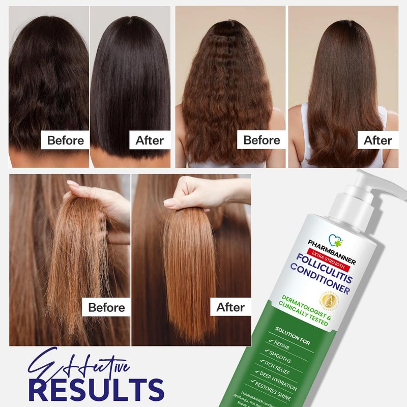 PHARMBANNER Folliculitis Itch Relief Conditioner: Tea Tree Oil & Moroccan Argan Oil - Deep Hydration & Repair - Nourishes, Smooths, Restores Shine - Safe for Dry or Damaged Hair-11.84 oz - Image 3