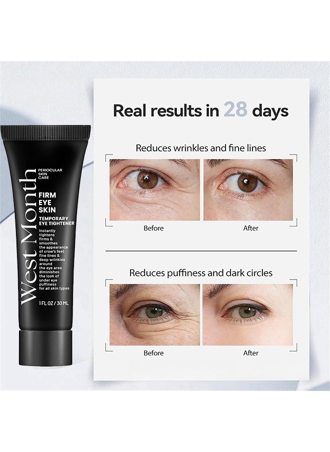 West&Month Firm Eye Skin,Temporary Eye Tightener Eye Cream, Anti-Aging Wrinkles Eye Cream, Eye Cream for Dark Circles and Reduce Puffiness, Fade Fine Lines Firm and Smooth Skin 30ml  - Image 4