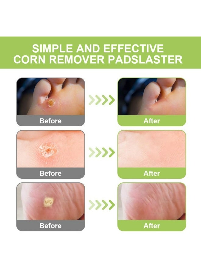 سوميفون 42 قطعة من رقعة إزالة مسامير القدم - ضمادة طبية لإزالة الكالو بسرعة وفعالية، علاج بمكونات طبيعية للمسامير والثآليل الأخمصية، مزيل لمسامير القدم للبشرة القاسية، رقعة حماية من البثور للمسامير والثآليل، شرائط إزالة الثآليل للعناية بالقدمين - Image 5