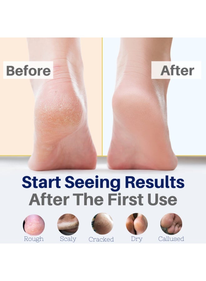 The Yellow Bird Yellow Bird Foot Cream â€“ Hydrating Tea Tree Oil Foot Balm with Essential Oils. Natural Athletes Foot Treatment. Moisturizing Cracked Feet Repair & Callus Remover. Made In USA - 2 oz - Image 3