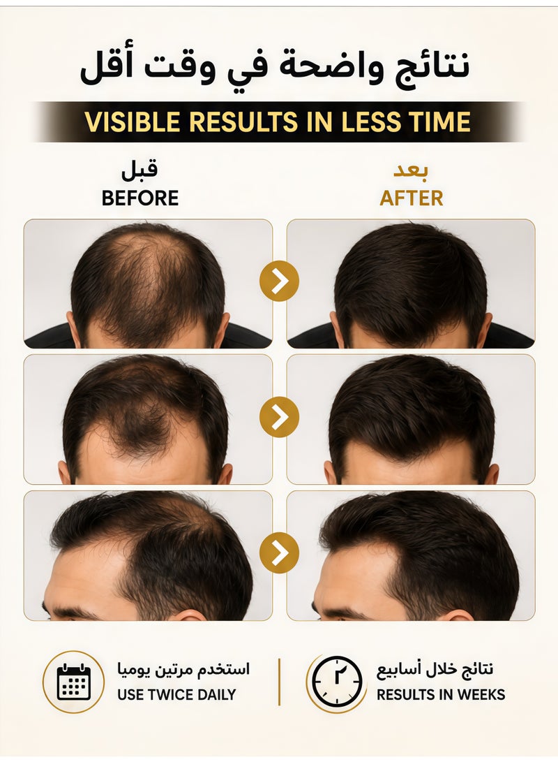 LUNOON 5% Minioxidil Hair Growth Serum for with Biotin Regrowth Hair Treatment For Thickens Hair Promotes Hair Density Help to Stop Thinning loss Hair stimulates Hair Growth, Regain Hair Serum-60ml - Image 2