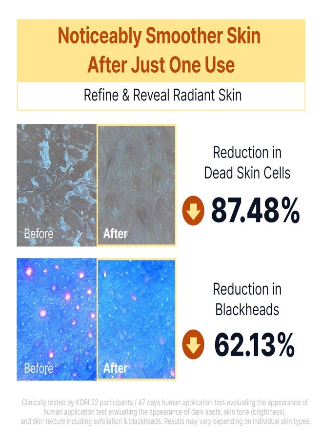 SUNGBOON EDITOR Kojic Acid Peel Shot Serum – Exfoliating Dark Spot Care with Rice Water, Niacinamide, AHA BHA PHA & Hyaluronic Acid, Brightening Facial Serum for Even Tone, 1.01 fl oz - Image 4