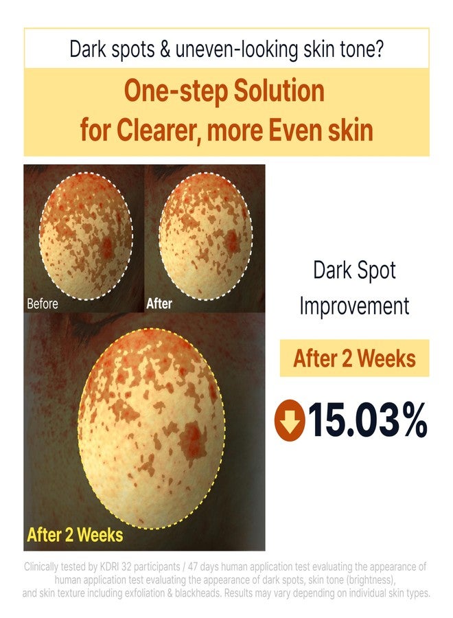 SUNGBOON EDITOR Kojic Acid Peel Shot Serum – Exfoliating Dark Spot Care with Rice Water, Niacinamide, AHA BHA PHA & Hyaluronic Acid, Brightening Facial Serum for Even Tone, 1.01 fl oz - Image 3
