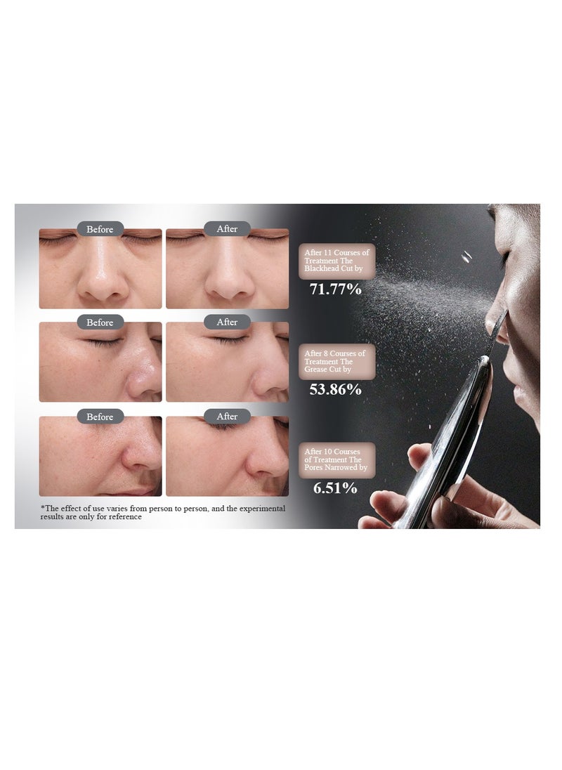 TOUCHBeauty TOUCHBeauty Ultrasonic Facial Skin Scrubber- Professional Skin Spatula Blackhead Removal Pores Cleaner Wrinkle Remover for Deep Cleansing, Exfoliation- 5 Modes, Wireless Charging  - Image 3