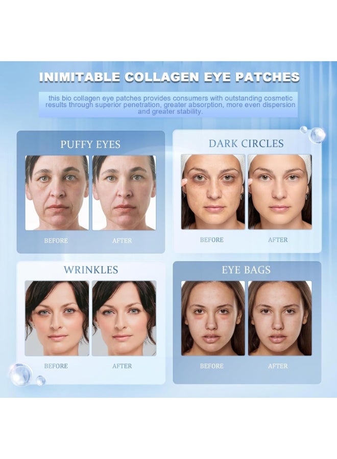 EELHOE Bio-Collagen Eye Patches – 30 Pairs丨Under Eye Patches for Dark Circles, Puffiness, Fine Lines丨With Vegan Collagen, Hyaluronic Acid, Niacinamide, Vitamin E丨Hydrating, Anti-Aging丨Korean Skincare - Image 5