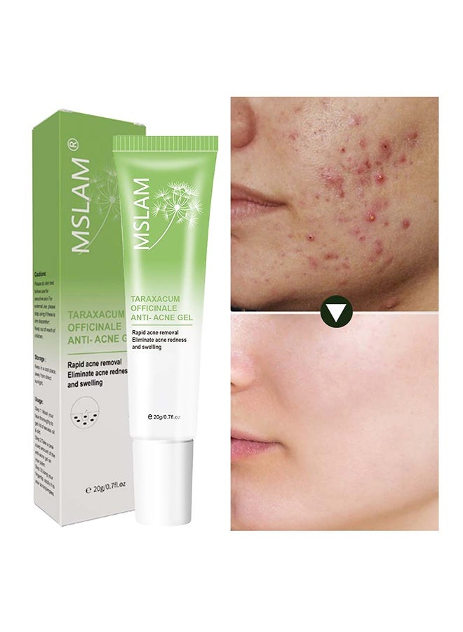 MSLAM Taraxacum Officinale Anti-Acne Gel ,with Dandelion Root Extract for Powerful Acne , Herbal Acne Gel, Powerful Acne Treatment Reduce the Appearance of Pimples and other Blemishes - Image 1