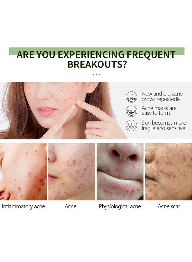 MSLAM Taraxacum Officinale Anti-Acne Gel ,with Dandelion Root Extract for Powerful Acne , Herbal Acne Gel, Powerful Acne Treatment Reduce the Appearance of Pimples and other Blemishes - Image 2