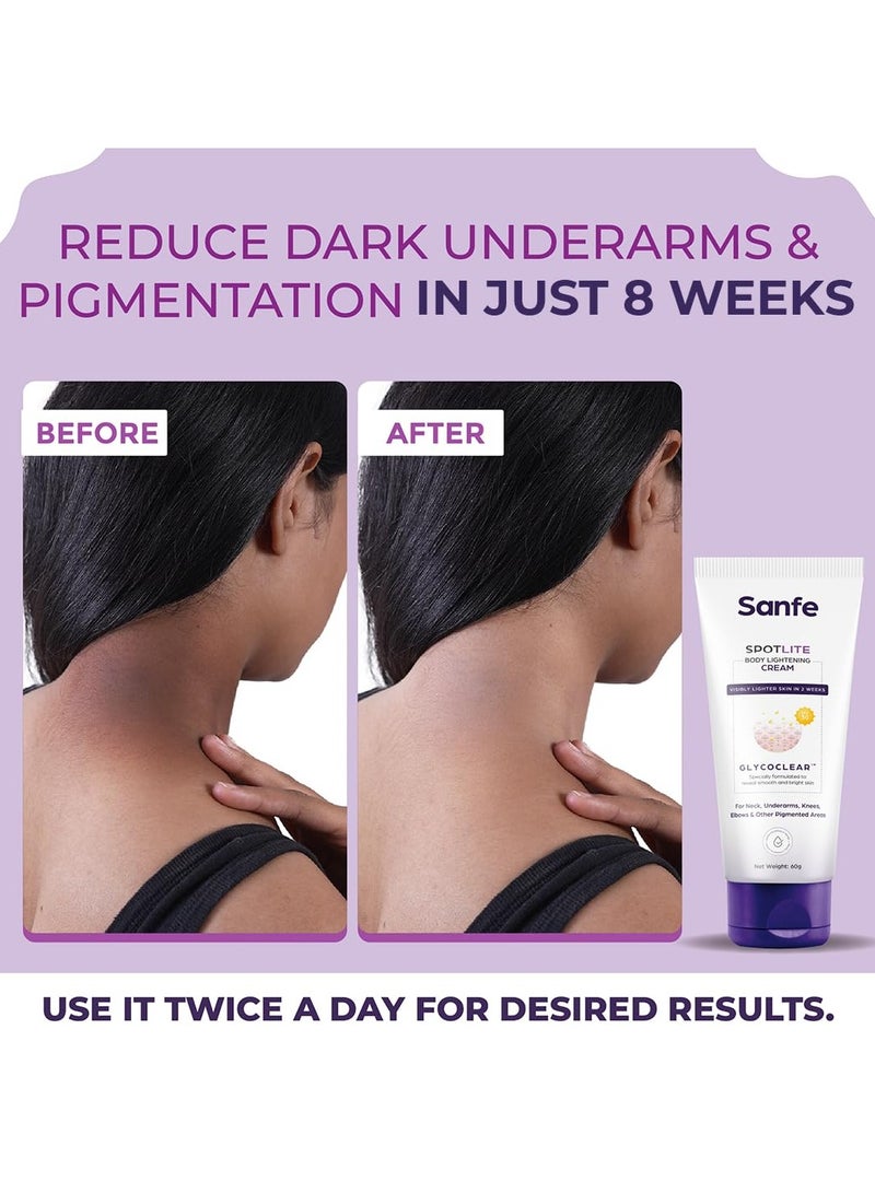 Sanfe Spotlite Body Cream Dark Neck Joints Skinfolds 3% Lactic Acid Retinol SPF 15 Detanning Anti Aging Tightening 60gm - Image 2