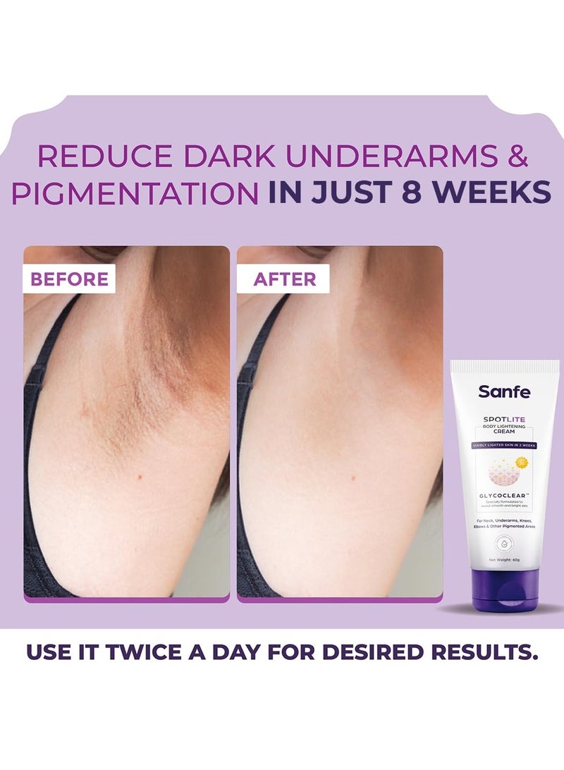 Sanfe Spotlite Body Cream Dark Neck Joints Skinfolds 3% Lactic Acid Retinol SPF 15 Detanning Anti Aging Tightening 60gm - Image 3