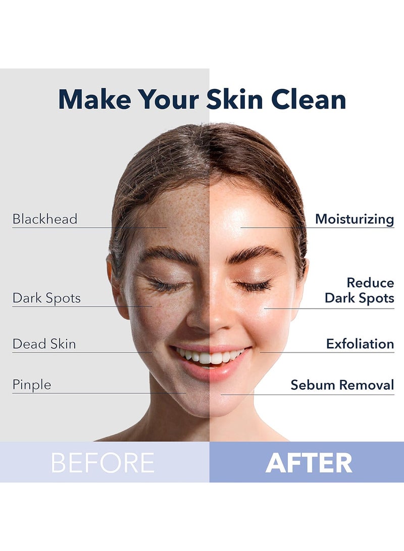 بيور ديرم قناع الفقاعات الوردي المنقي العميق بالخوخ من بيورديرم - Image 3