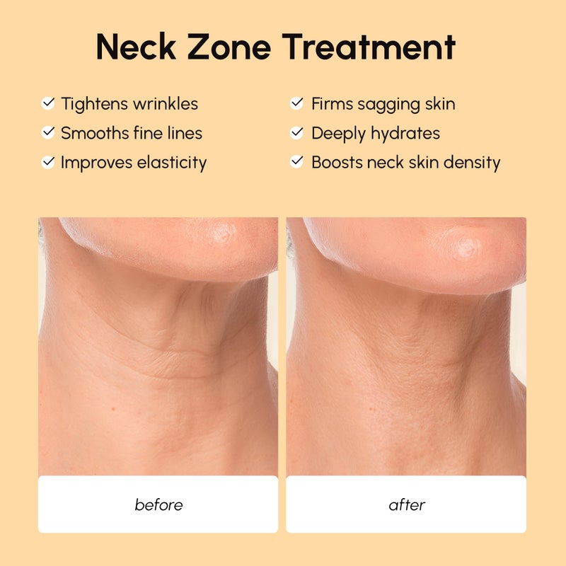 MAREE Neck Wrinkle Patches â€“ Collagen Anti-Wrinkle Patches with Retinol & Hyaluronic Acid for Face Lift â€“ Neck Mask for Tightening and Firming â€“ Neck Lifting Mask & Face Tape for Neck Wrinkles â€“ 5 Pcs - Image 3