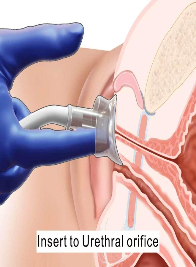 Pakerler Wicks Female External Catheter Cup for Women - Disposable External Urinary Incontinence Support for Home Care and Daily Use - Image 4