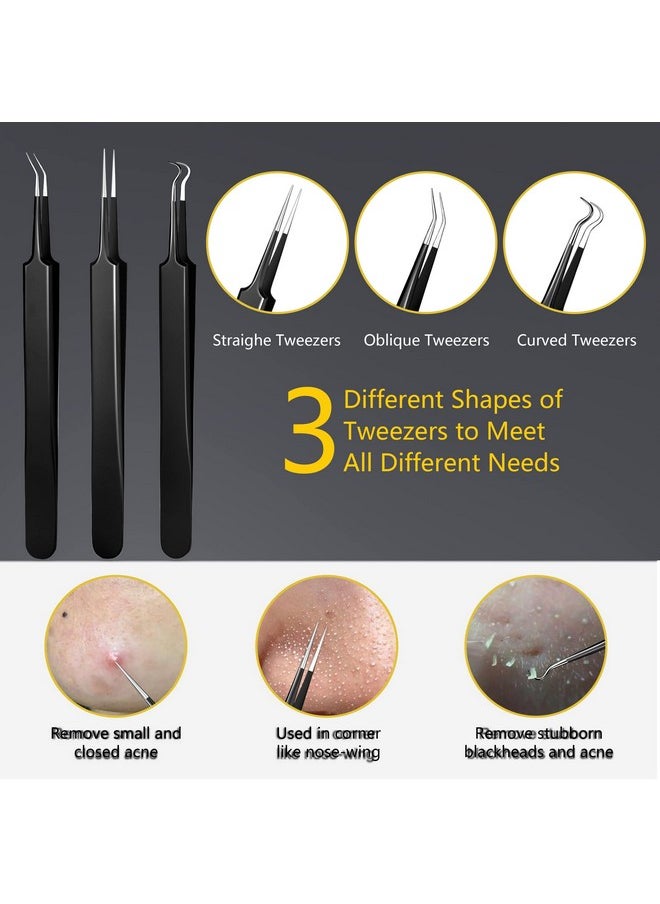 EvaHab - 19 Pcs Blackhead Remover Pimple Popper Tool Kitprofessional Blackhead Extractor Tool For Nose Face Stainless Comedone Extractor Blemish Whitehead Popping Tool With Portable Metal Case (Black) - Image 1