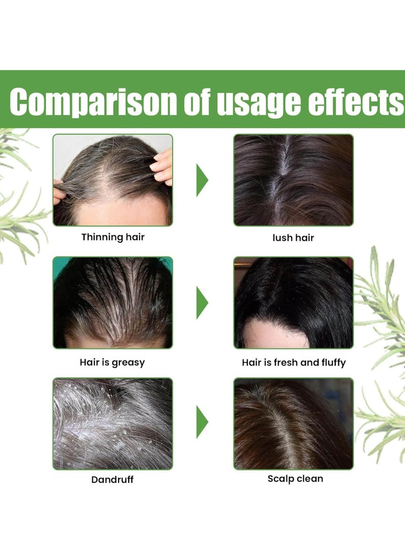 EELHOE - Rosemary shampoo fluffy refreshing soft smoothing dry frizz anti-fall growth hair oil control, help hair growth, suitable for all hair types-1pcs - Image 1