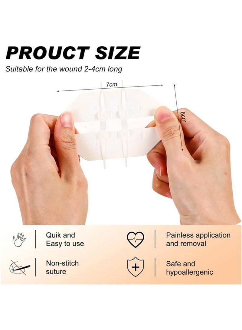 Generic 2pcs Emergency Wound Closure Strip Wound Closure Kit Zip Stitch Wound Closure Device Laceration Closure Kit Wound Closure Glue Bandages Sutures to Close The Cut 6x7cm  - Image 2