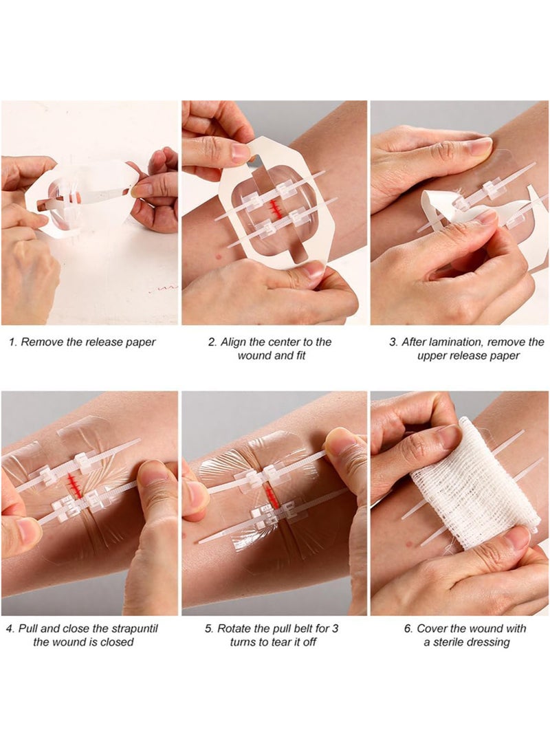 Generic 2pcs Emergency Wound Closure Strip Wound Closure Kit Zip Stitch Wound Closure Device Laceration Closure Kit Wound Closure Glue Bandages Sutures to Close The Cut 6x7cm  - Image 4