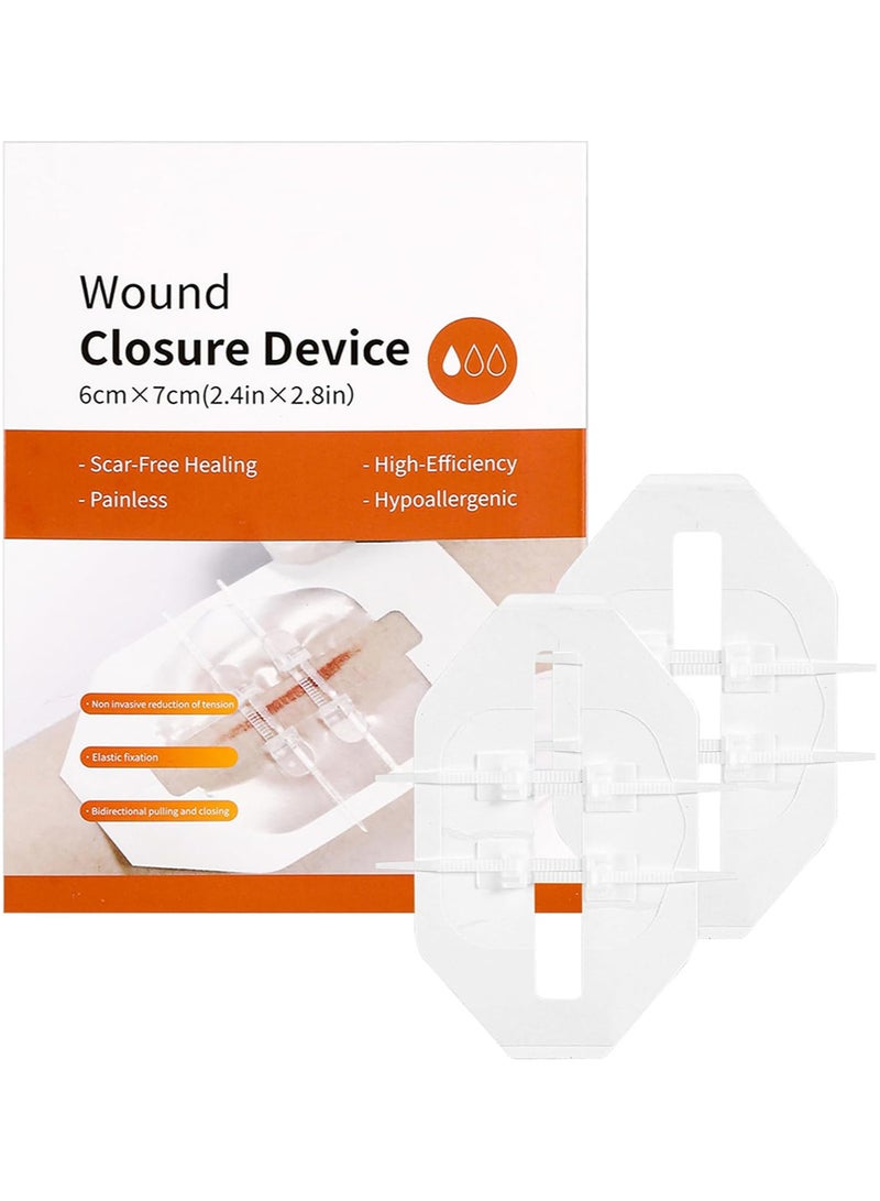 Generic 2pcs Emergency Wound Closure Strip Wound Closure Kit Zip Stitch Wound Closure Device Laceration Closure Kit Wound Closure Glue Bandages Sutures to Close The Cut 6x7cm  - Image 1