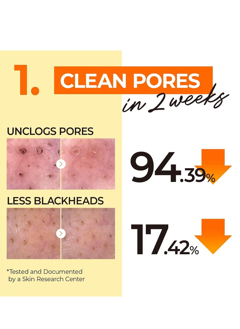 numbuzin - Nombuzzden Easy Peasy Cleansing Oil, Facial Cleanser to Remove Makeup, Unclogs Pores, Non-Heavy Ingredients, Naturally Derived, Korean Facial Care, 6.7 Fluid Ounce - Image 1