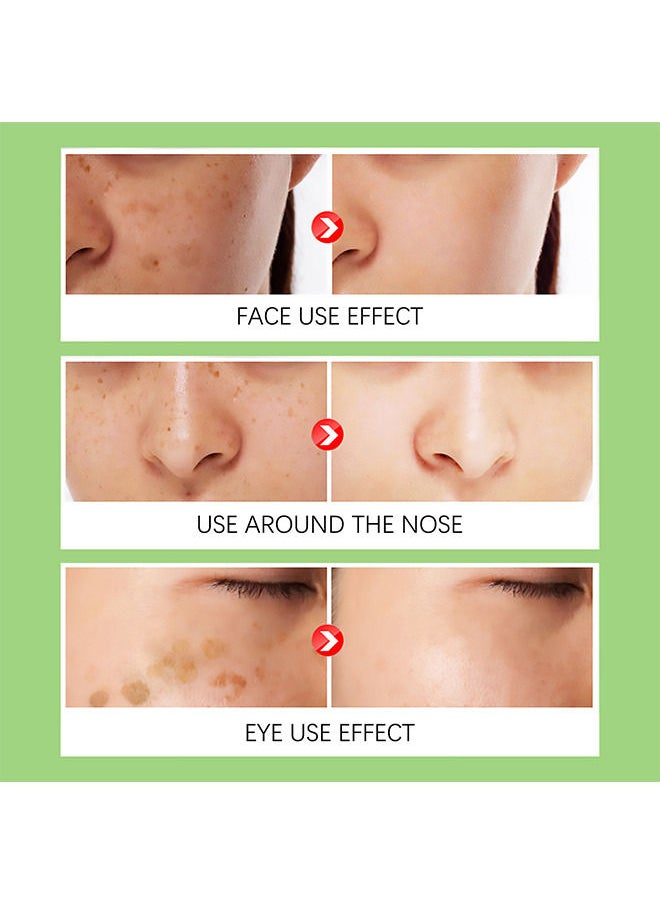 Jaysuing - Dark Spot Remover For Face - Fast-Acting Dark Spot Corrector Remover For Face And Body Hyperpigmentation - Fades Melasma - Freckle - Sun Spots - Evens Skin Tone - Age Spot Remover - Image 1