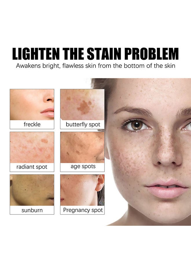 Jaysuing - Dark Spot Remover For Face - Fast-Acting Dark Spot Corrector Remover For Face And Body Hyperpigmentation - Fades Melasma - Freckle - Sun Spots - Evens Skin Tone - Age Spot Remover - Image 1