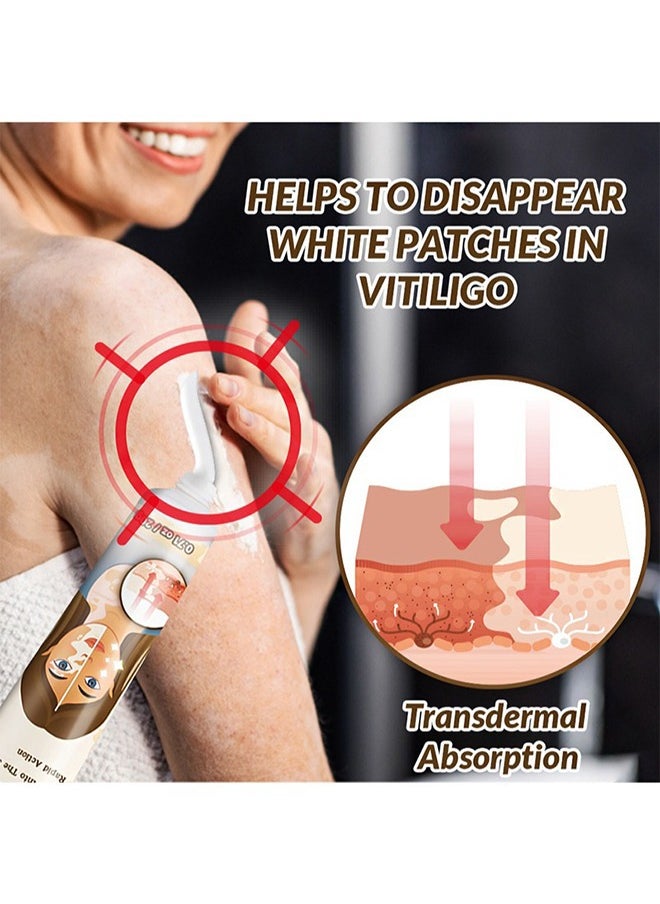 Sumifun - Vitiligo Removal Cream, Skin Vitiligo Treatment, Vitiligo Care Cream Reduces White Spots and Improves Skin Pigmentation (20g) - Image 1