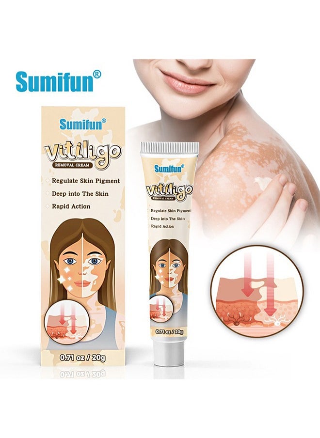 Sumifun - Vitiligo Removal Cream, Skin Vitiligo Treatment, Vitiligo Care Cream Reduces White Spots and Improves Skin Pigmentation (20g) - Image 1