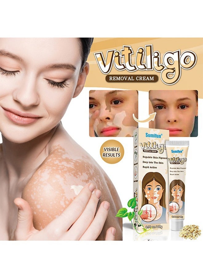 Sumifun - Vitiligo Removal Cream, Skin Vitiligo Treatment, Vitiligo Care Cream Reduces White Spots and Improves Skin Pigmentation (20g) - Image 1