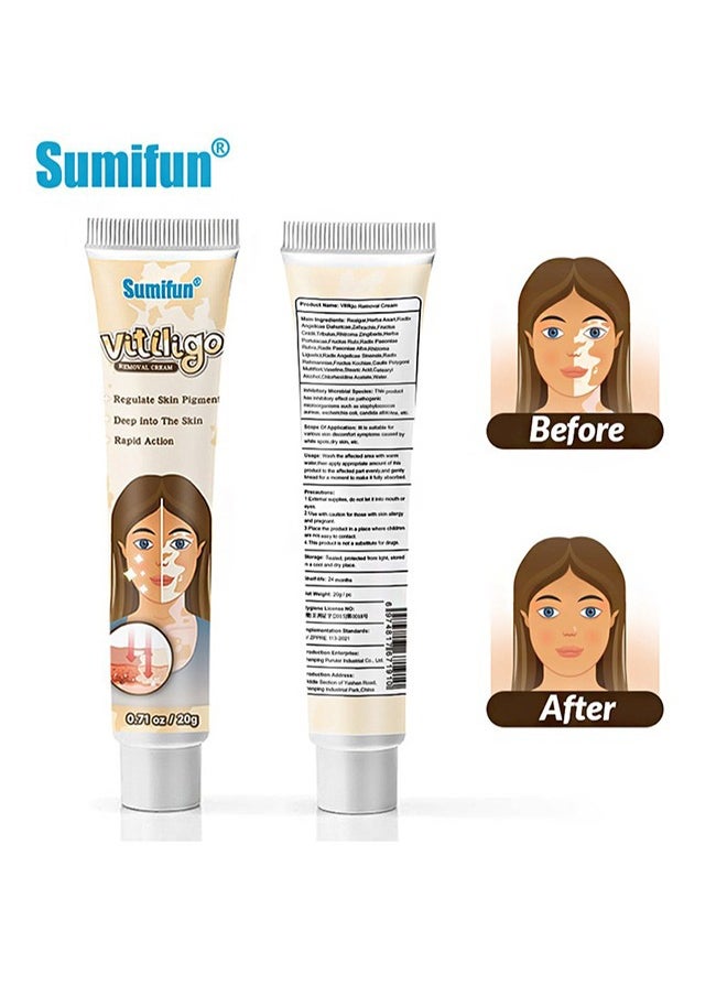 Sumifun - Vitiligo Removal Cream, Skin Vitiligo Treatment, Vitiligo Care Cream Reduces White Spots and Improves Skin Pigmentation (20g) - Image 1