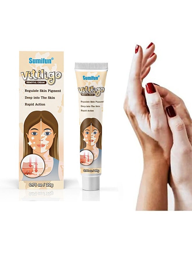 Sumifun - Vitiligo Removal Cream, Skin Vitiligo Treatment, Vitiligo Care Cream Reduces White Spots and Improves Skin Pigmentation (20g) - Image 1