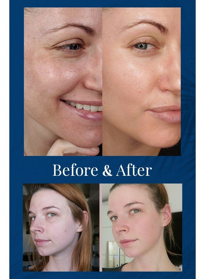 تليت لابوراتوري سيروم الوجه  للتقشير وإشراق — نياسيناميد + حمض الهيالورونيك + رقائق الذهب — 30 مل - Image 3