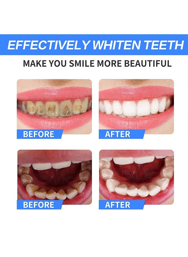 Sefudun Whitening Toothpaste,Teeth Whitening Soda Toothpaste Cleaning Hygiene Stain Removal Anti Bleeding Gums-Blue Berry - Image 4