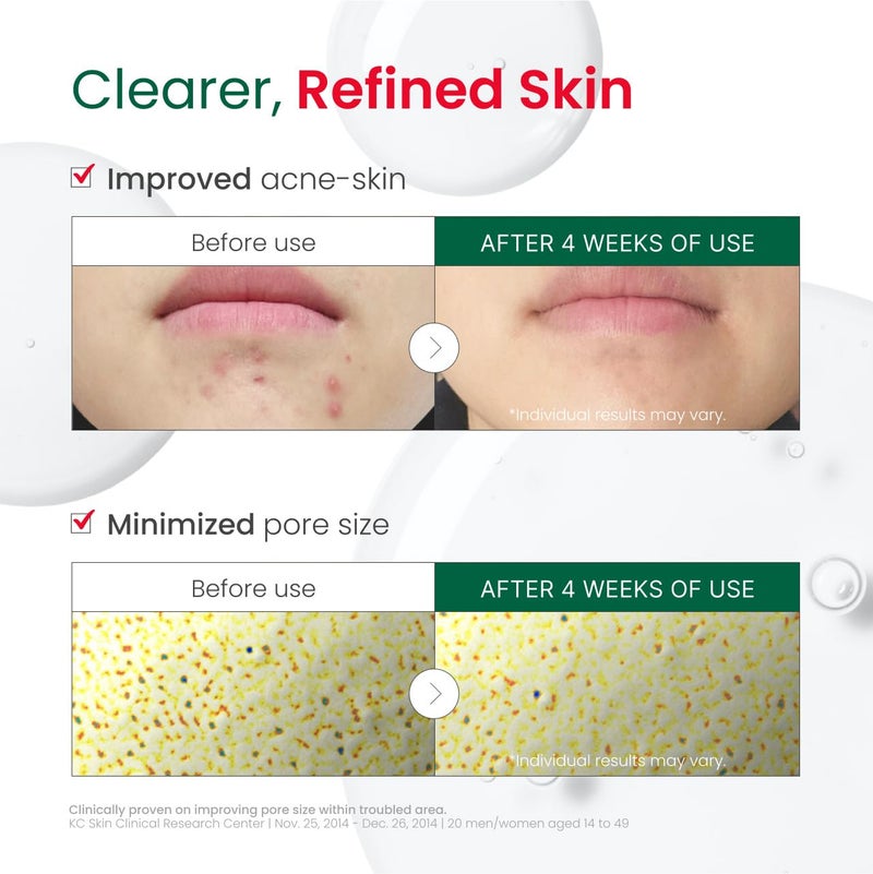 Dr. G R.E.D. Blemish Clear Hyal-Cica Soothing Serum - Korean Skincare - Long-Lasting, Hydrating Serum for All Skin Types - Cools Skin Temperature - Hyaluronic Acid & Centella Asiatica - 1.69 fl oz - Image 5