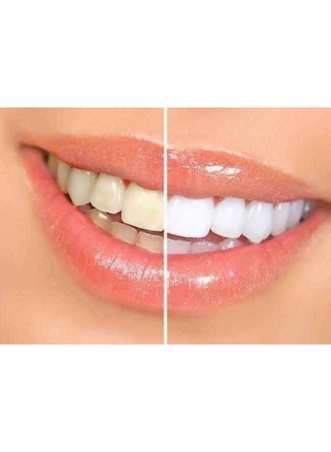 دازيلنج وايت قلم لتبييض الأسنان (يُستخدم 50 مرة) أبيض 2.0جرام - Image 3