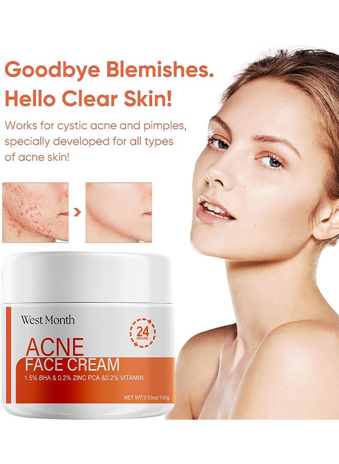 West&Month Acne Face Cream, Acne Spot Treatment For Face And Acne Dots, Natural Cystic Acne Treatment, Acne Moisturizer, Premium Acne Scar Cream And Pimple Remover 100G  - Image 2