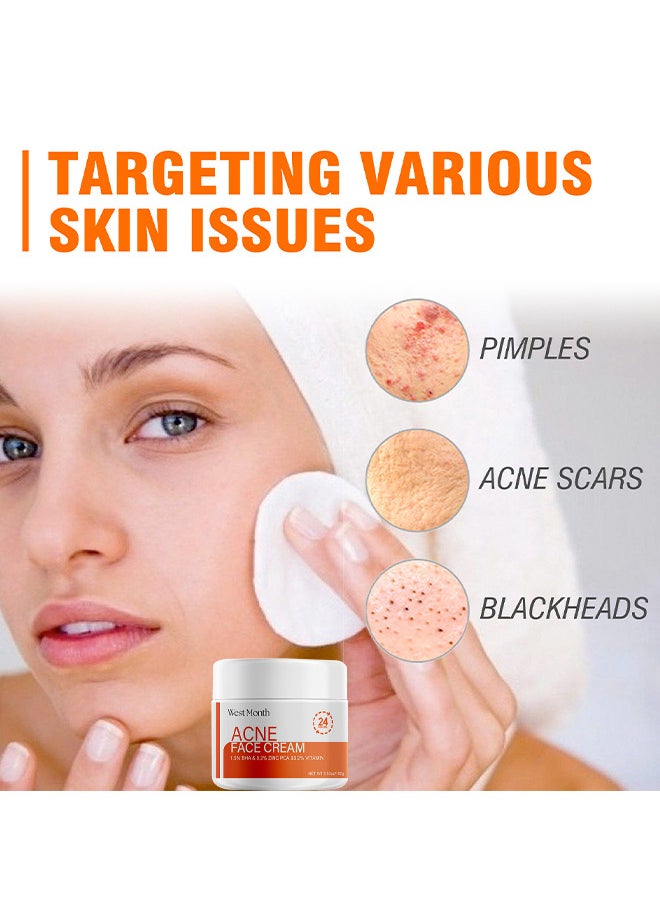 West&Month Acne Face Cream, Acne Spot Treatment For Face And Acne Dots, Natural Cystic Acne Treatment, Acne Moisturizer, Premium Acne Scar Cream And Pimple Remover 100G  - Image 4