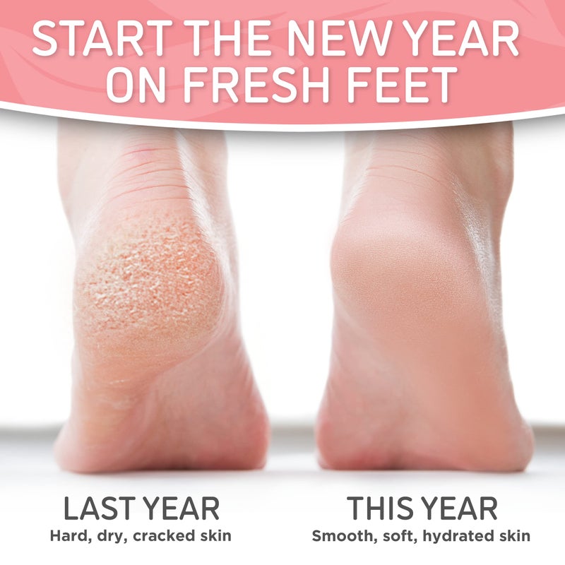 Dermora Soft Touch Exfoliating Foot Peel Mask â€“ Pack of 2 - For Dry, Cracked Heels, Calluses & Baby Soft Skin - Peppermint - Exfoliating Foot Peeling Mask - Image 4