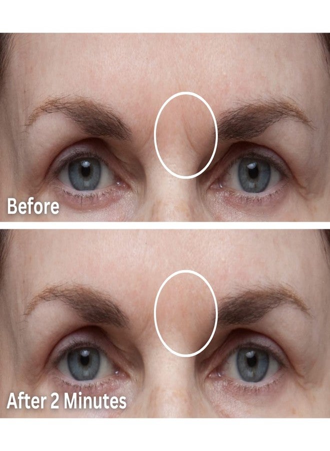 dermaflage ديرمافلاج ملء الندبات إعادة تعبئة، 4 أدوات تطبيق - Image 3