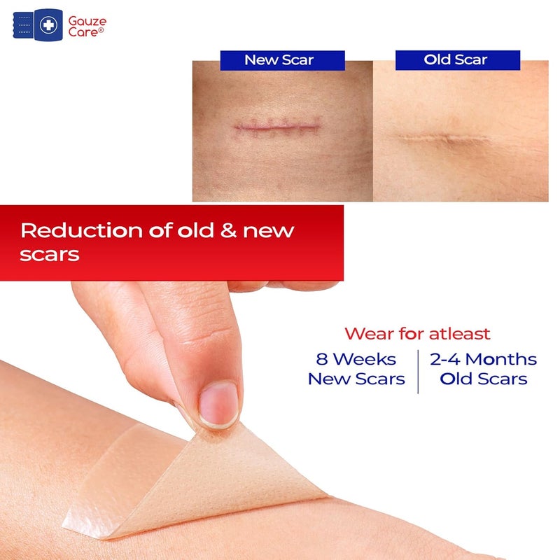 Gauze Care شريط سيليكون لعلاج الندبات من غوز كير 16x120 رول درجة طبية قابل لإعادة الاستخدام شريط سيليكون احترافي لعلاج الندبات الجراحية وندبات القيصرية والحروق والكيلايد وندبات حب الشباب - Image 4
