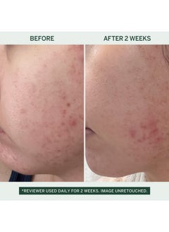 FACETORY Urban Calm Hydrating Vita Serum - Glow Boosting Facial Serum with Fermented Mung Bean & 10% Niacinamide for Fine Lines & Wrinkles - Plump & Revive Dry Skin - Smoothing & Calming - 30ml / 1.01 fl oz  - Image 2
