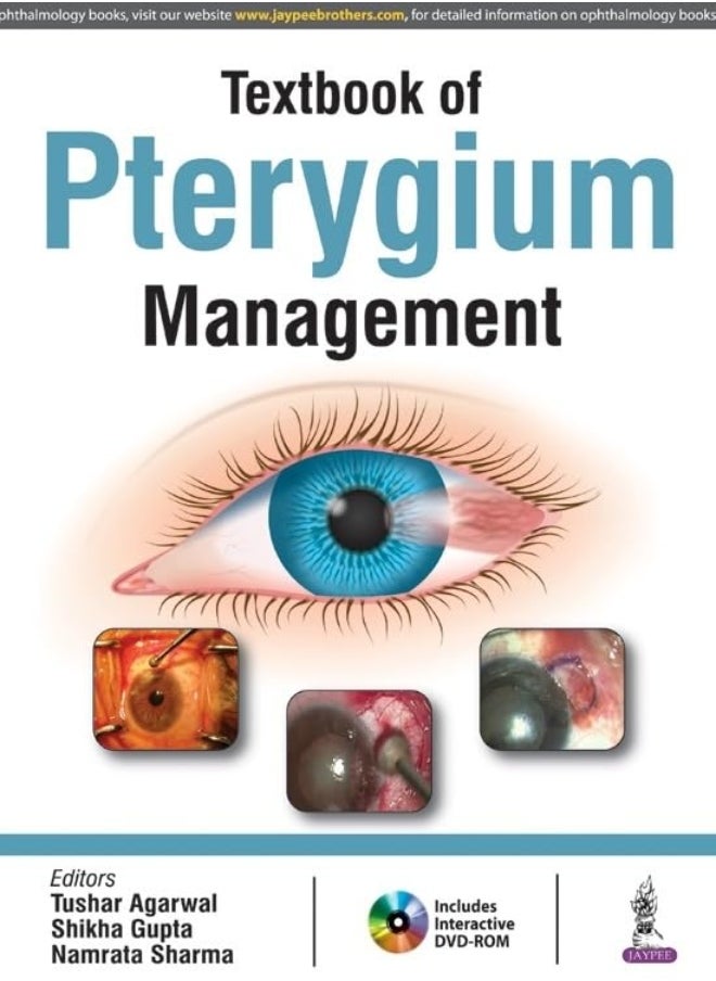 Textbook of Pterygium Management 