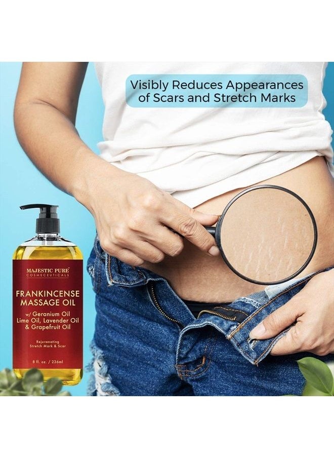 Stretch Mark and Scar Frankincense Massage Oil by Majestic Pure, for Softer & Smoother Skin - Visibly Reduces Appearances of Scars and Stretch Marks - 8 fl oz - pzsku/ZCAC740F39275DD1AEAC0Z/45/_/1681225079/8e5dbda3-65cc-43ea-a202-7ed312ccd0ab