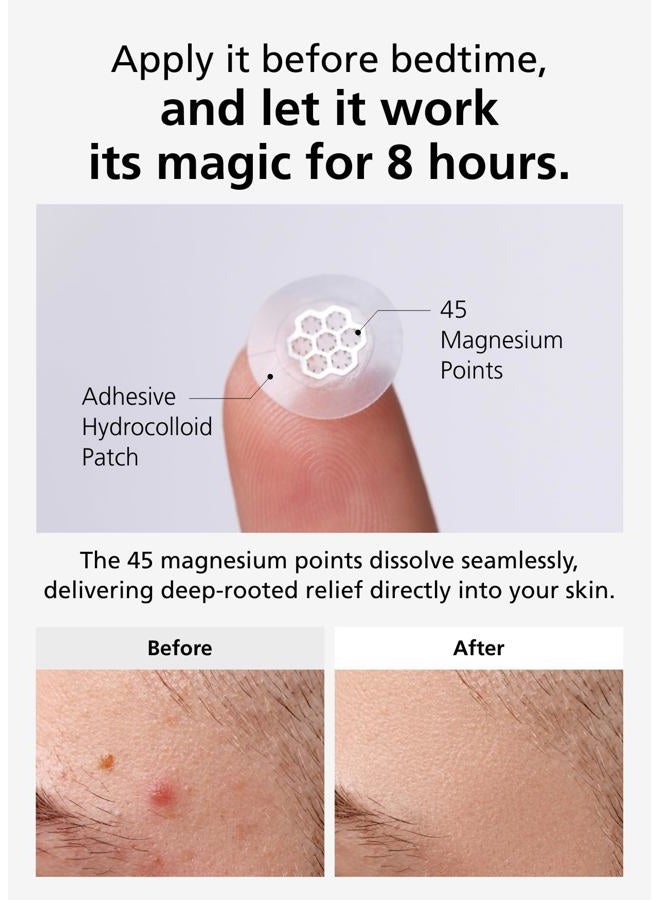Dweasyderm Quick Calming Magnesium Patches(20 Patches) With Cica Ampoule - Intensive Care, Pimple Patches, Hydrocolloid Band, Zits Spot Care Overnight Home 2-8 Hours, New Boxs Types - Image 5