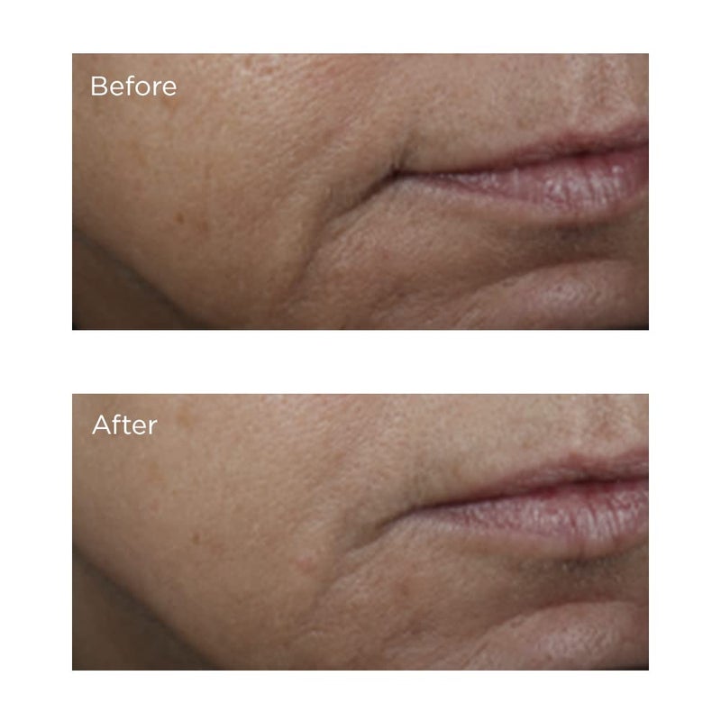 Perricone MD بيريكون MD فيتامين C إستر لرفع الوجه المشرق، 2 أونصة سائلة (عبوة من 1) - Image 4