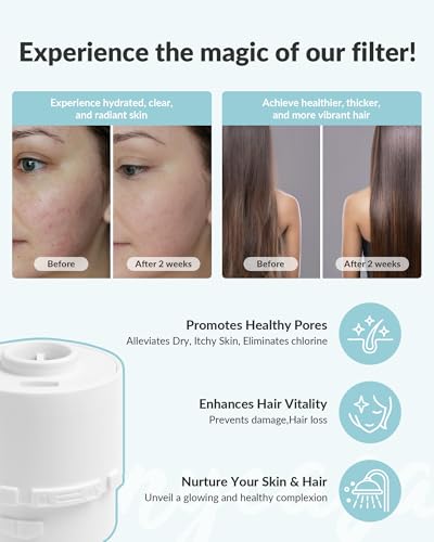 SANYCASA Filtered Shower Head for Hard Water, Removes Chlorine & Heavy Metals, KDF-55 Filter for Healthier Hair & Skin, Protects Colored Hair, High Pressure, Dermatologist Recommended(CP) - Image 5
