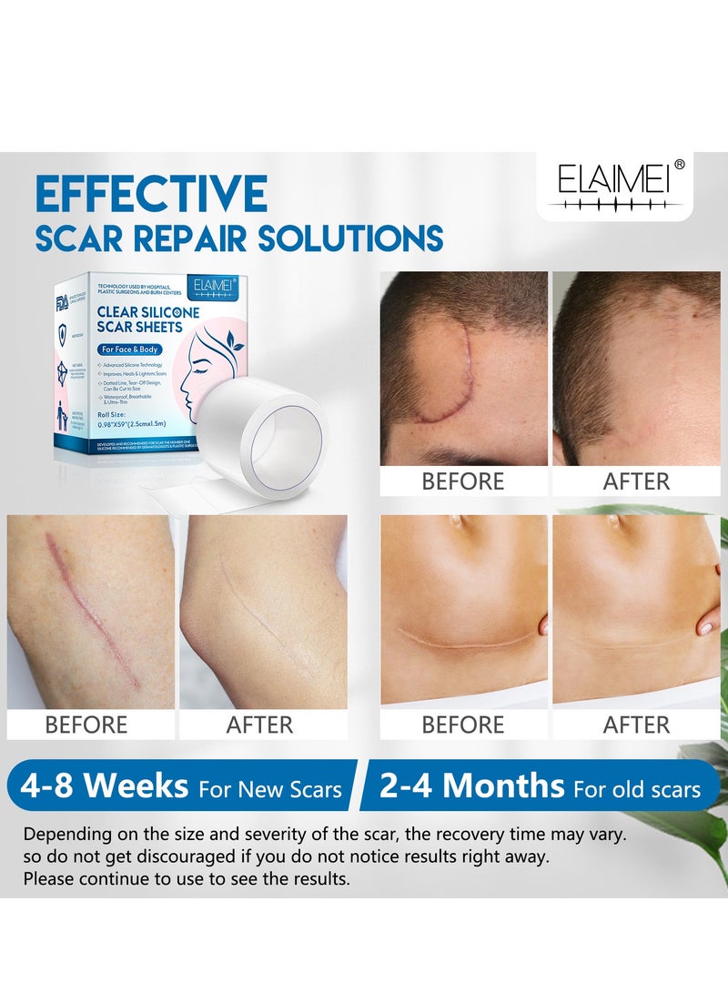 Elaimei 2.5cmx1.5m Clear Silicone Scar Sheets for Face and Body, Silicone Scar Tape, Scar Removal Strips for Acne Scars C-Section & Keloid Surgery Scars Sheets Treatment Sheets Stretch Marks Treatment Waterproof Scar Removal Sticker 4-8 Weeks Supply Medical Grade - Image 5