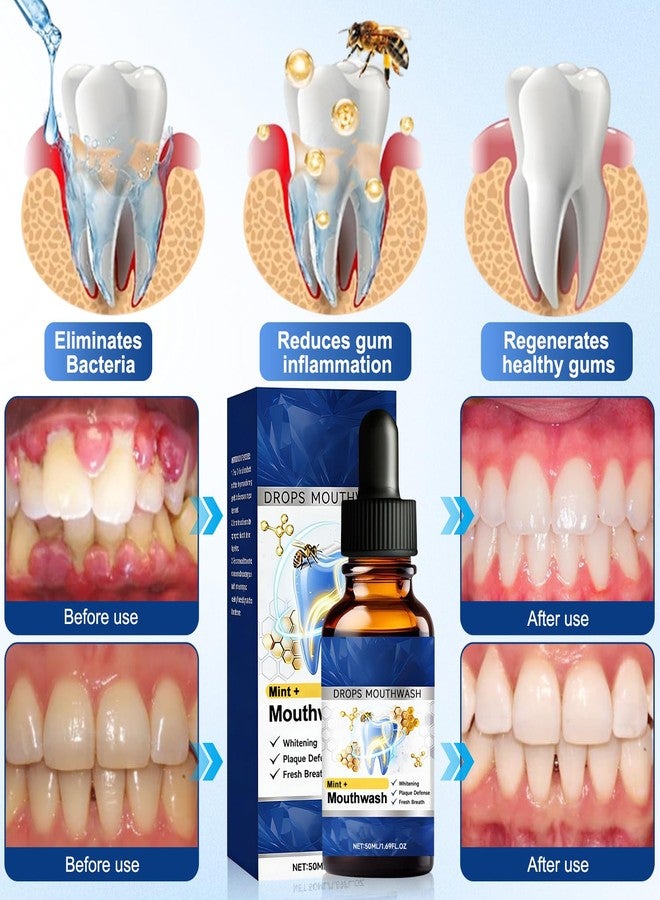 BSpecter 2PCS Beetakt Oral Repair Solution, Mint Flavored Oral Mouthwash, Professional Gum Restore Drops, Teeth Restoration, Effectively Improves Oral Hygiene and Freshens Breath - Image 2