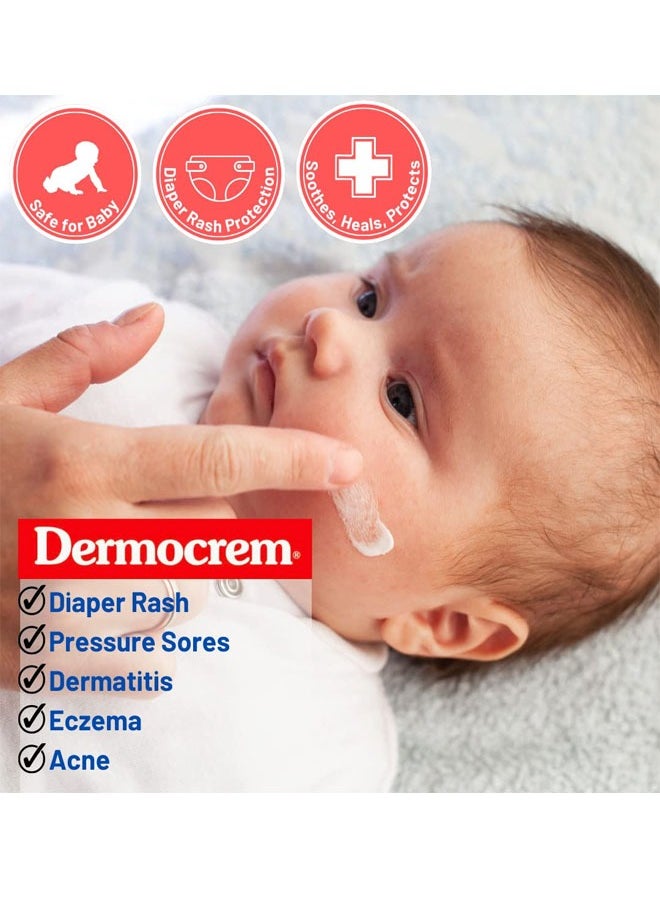 Sudocrem Antiseptic Healing Cream To Protect Rash And Surface Wound For Baby 125g,Soothes, Heals, And Protects, Relief And Treatment Of Diaper Rash, Developed To Provide Optimal Hydration And Moisturisation  - Image 3