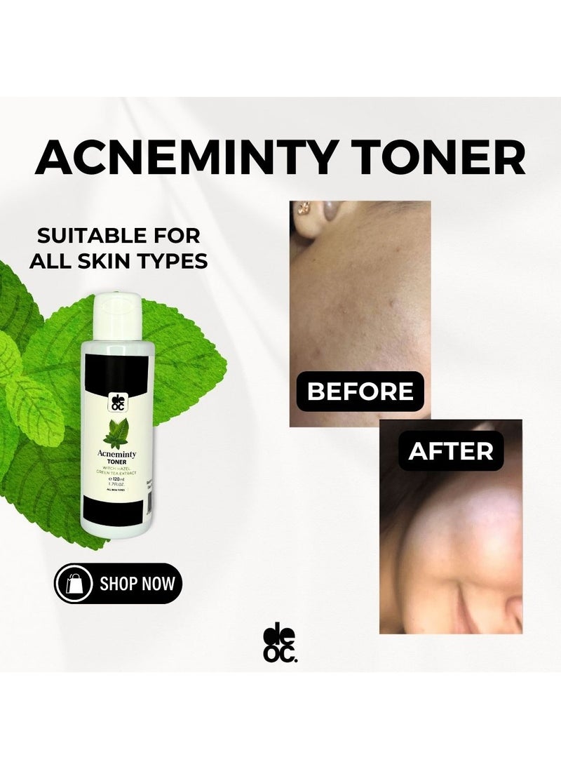 deoc - Acneminty Toner - Image 1