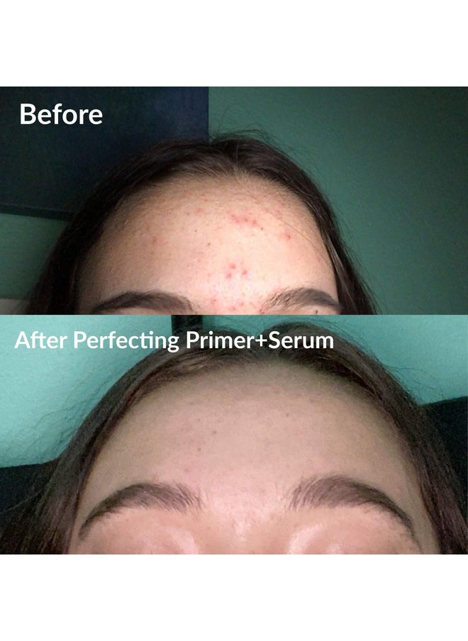 Frilliance - 2 In 1 Clear Skin Perfecting Primer & Serum For Acne Vegan Cruelty Free For Teens Of All Skin Types Mandelic Acid & Niacinamide Fights Breakouts Blackheads 15 Ml / .5 Fl Oz - Image 1